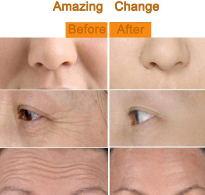 Avoccado Beé® 24K Gold Facial Roller